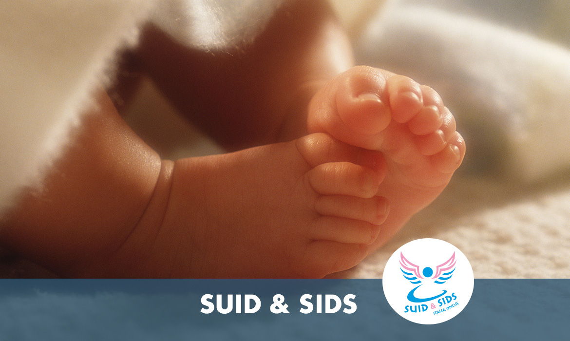 SUID-SIDS